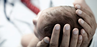 Гемангиома у новорожденного: причины возникновения, виды, лечение