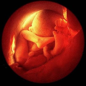 Эмбрион на 37 неделе Эмбрион на 37 неделе