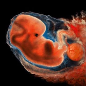Эмбрион на 5 неделе Эмбрион на 5 неделе